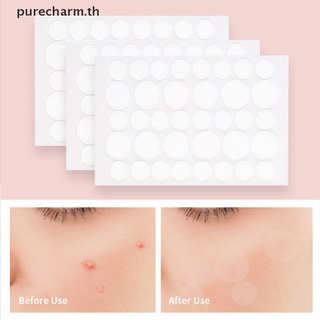 [aglanceofjinhui&amp;th] แผ่นสติกเกอร์แปะสิว ดูดซับ Pus และ Oil Acne Patch