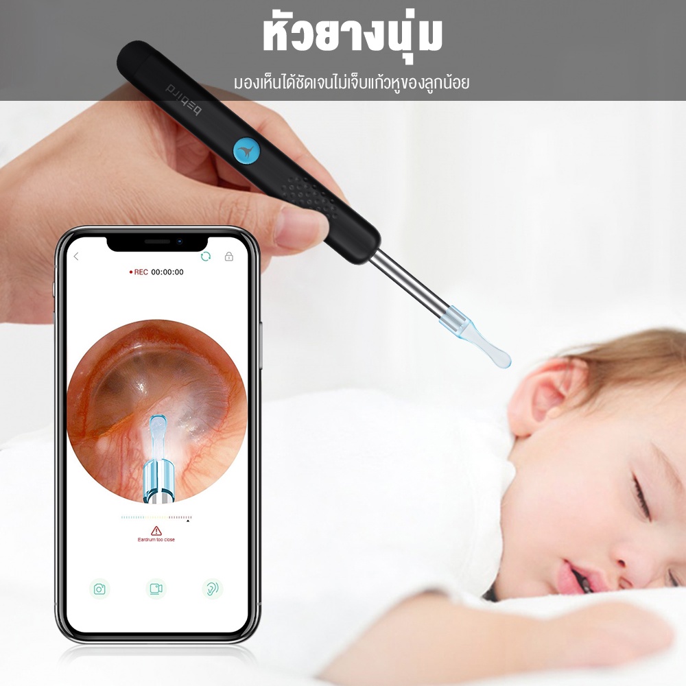 Xiaomi Bebird R1 ที่แคะหูเด็ก ไม้แคะหูอัจฉริยะ แคะหู ไม้แคะหู ไม้แคะหูมีกล้อง Earpick