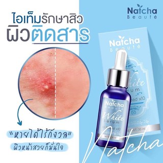 เซรั่มณัชชา NATCHA💧เซรั่มสลายฝ้า