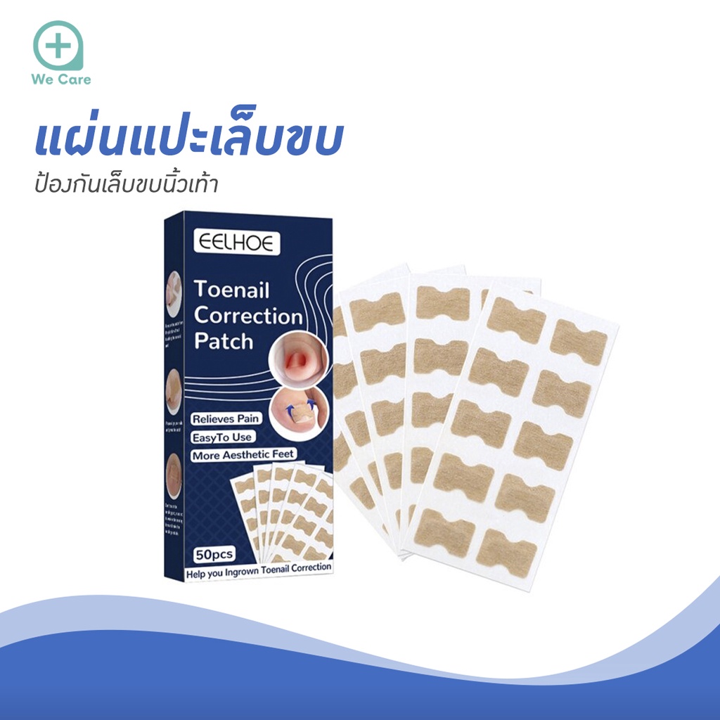 EELHOE แผ่นแปะเล็บขบ ป้องกันเล็บขบนิ้วเท้า แผ่นแปะดูแลเล็บเท้า บำรุงเล็บ มีกาวในตัว (1กล่อง/50แผ่น)