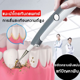 เครื่องล้างฟันอัลตราโซนิกไฟฟ้า เครื่องล้างฟัน ทำความสะอาดฟัน ทำทันตกรรมทำความสะอาดฟัน เครื่องมือดูแลฟัน ฟันขาว กำจัดคราบ