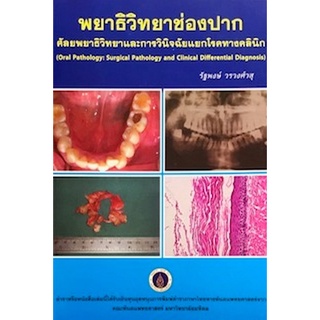 Chulabook(ศูนย์หนังสือจุฬาฯ) |C111หนังสือ9786163481184พยาธิวิทยาช่องปาก :ศัลยพยาธิวิทยาและการวินิจฉัยแยกโรคทางคลินิก (ราคาปก 1,200.-)