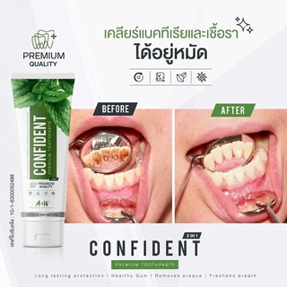 ยาสีฟันConfident แท้100%👏👏ใช้ มาหลาย ยี่ห้อ แปรง 3เวลา ก็ยัง มี กลิ่นปาก ได้ใช้ คอนฟิเด้น 3วัน กลิ่นปาก ไม่มี คือดี มาก