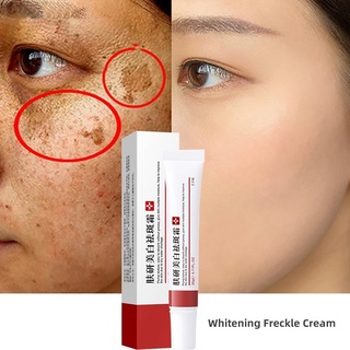 ครีมไวท์เทนนิ่งเมลาสม่าครีมลดรอยจุดด่างดํา Melasma ครีมต่อต้านริ้วรอย