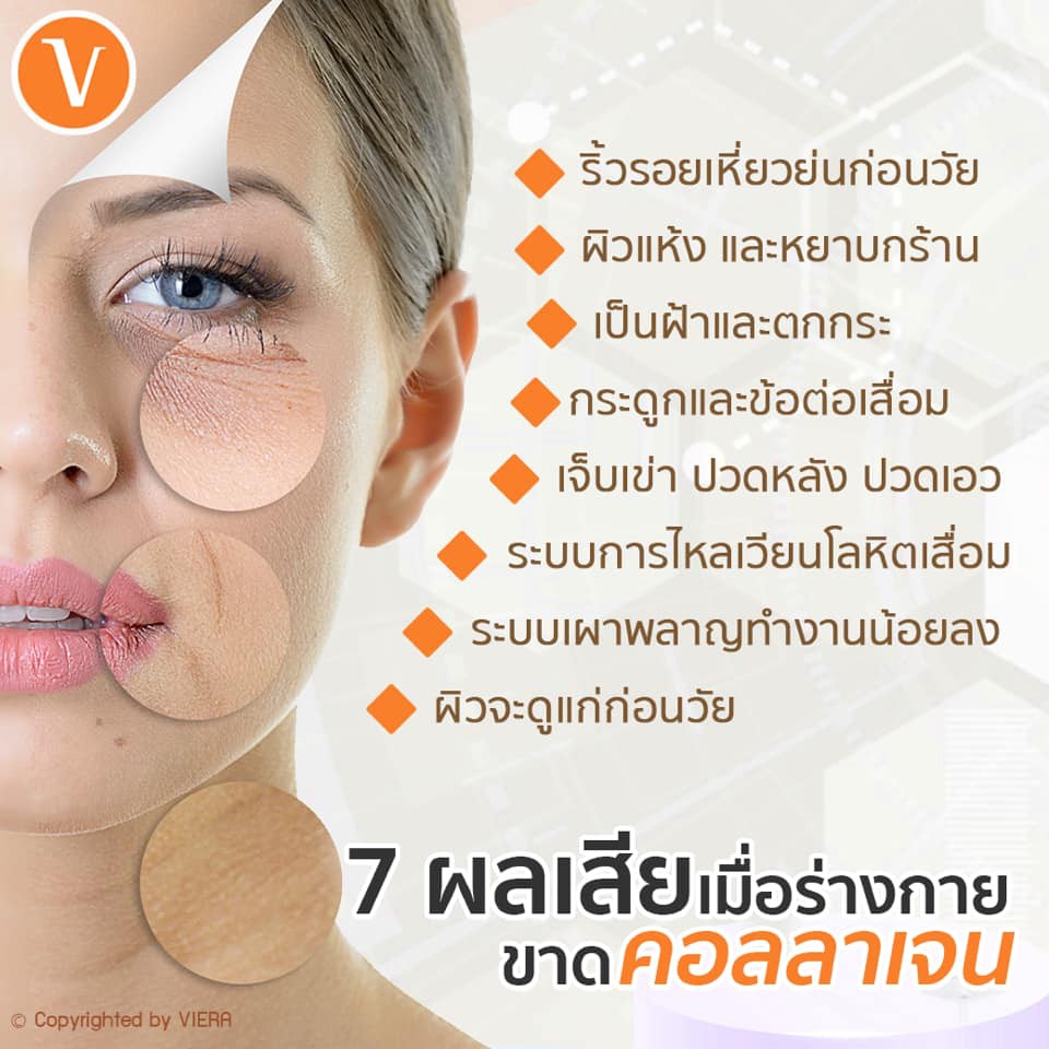 Seres collagen+วิตามินซี+Zinc แท้100% บำรุงผิว นุ่น ชุ่มชื่น ลดริ้วลอย ต้านอนุมูลอิสระ ริ้วรอยจากสิว - รูปที่ 6