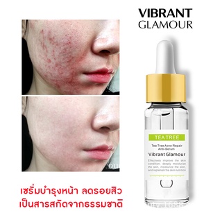 VIBRANT GLAMOUR ของแท้ 100% สูตร Tea Tree ครีมแต้มสิว ชาเขียว ครีมรักษาสิว ครีมลดสิว เจลรักษาสิว กำจัดสิวอักเสบ