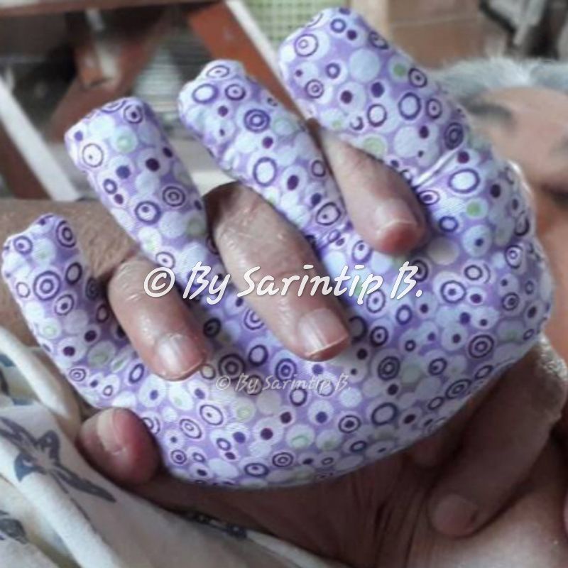 คุณช้างจับมือ หมอนมือ สำหรับผู้ป่วยติดเตียง ผู้ที่มีอาการแขนขาอ่อนแรง อัมพฤกษ์ อัมพาต ช่วยลดการเกิดแผลกดทับที่ฝ่ามือ
