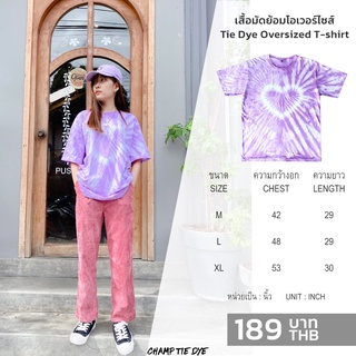 เสื้อยืดมัดย้อม โอเวอร์ไซส์ คอกลม ไซส์ใหญ่พิเศษ คนอ้วน เสื้อเด็ก ได้ทั้งชายหญิง Tie Dye Oversized  kids T-shirt unisex