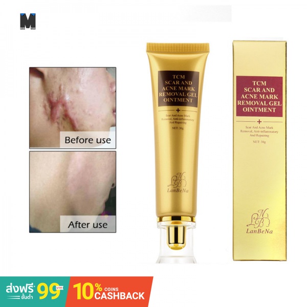 pimple marks clear cream