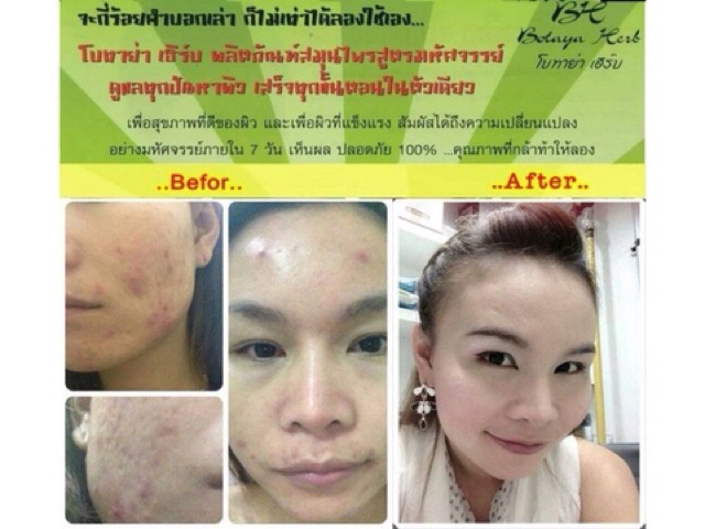 ถูกที่สุด แท้‼️ Botaya herb ชุดใหญ่  30 กรัม โบทาย่า เฮร์บ เพิ่มความสวย - รูปที่ 4