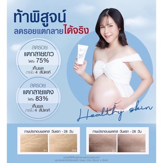 EVES อีฟ ลดรอยแผลเป็น Stretch Mask Body Oil Gel ป้องกันผิวแตกลาย ผิวนุ่ม ลดจุดด่างดำ รอยแตกลาย ครีมคนท้อง ผิวชุ่มชื้น