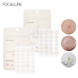 Focallure แผ่นมาส์กหน้าสําหรับรักษาสิว