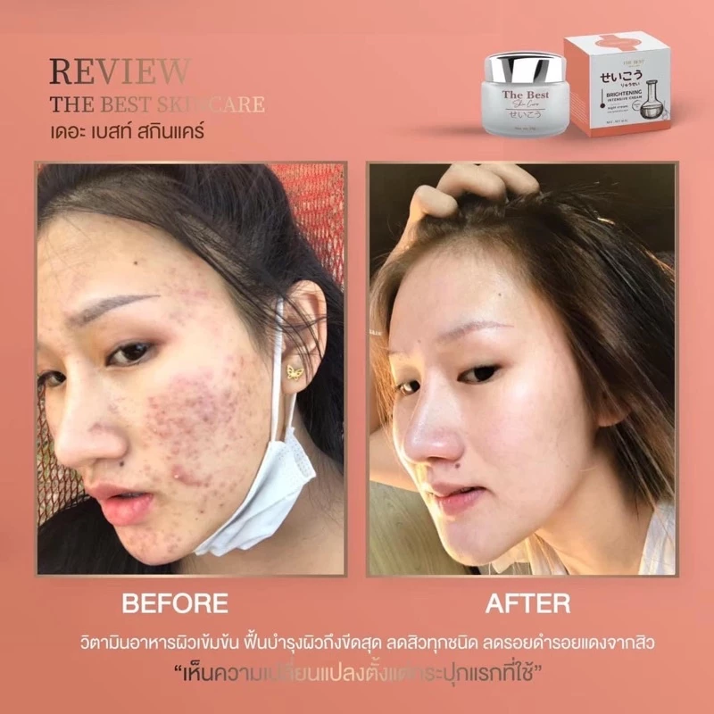 💯ของแท้แพ็คเกจใหม่ ไนท์ครีม The Best 🧡  เดอะ เบส สกินแคร์ [ส่งไว+ส่งฟรี+มีของแถม+มีปลายทาง] ครีมบำรุงผิวหน้า thumbnail 10