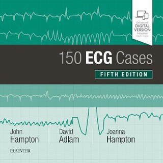 150 ECG Cases, 5ed - STD - ISBN : 9780702074585