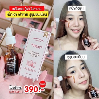 ของแท้ 100% (1ขวด)เซรั่มสตอเบอรี่ Yerpall Serum (15 ml)   🍓 ขนาด15ml ยืนหนึ่งไอเทอมลดรอยสิว