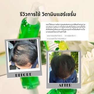 วิตามินบำรุงผม Hair Tonic 85มล. Dream&Star ลดผมมร่วง แก้คันศีรษะ