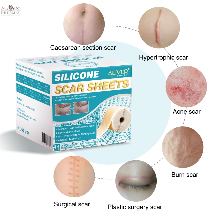 【DREAMER】ALIVER Silicone Gel Strips Patch Silicone Scar Sheets Reusable Silicone Scar Removal Patch Remove Trauma Burn