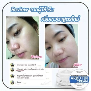 [ล๊อตใหม่ EXP5/2027]‼️ ครีมเทวดาอาบูติน [แพ็คเกจใหม่] ลดฝ้า กระ จุดด่างดำ อาบูตินครีม ครีมเทวดา ขนาด 10g [บัตรตัวแ