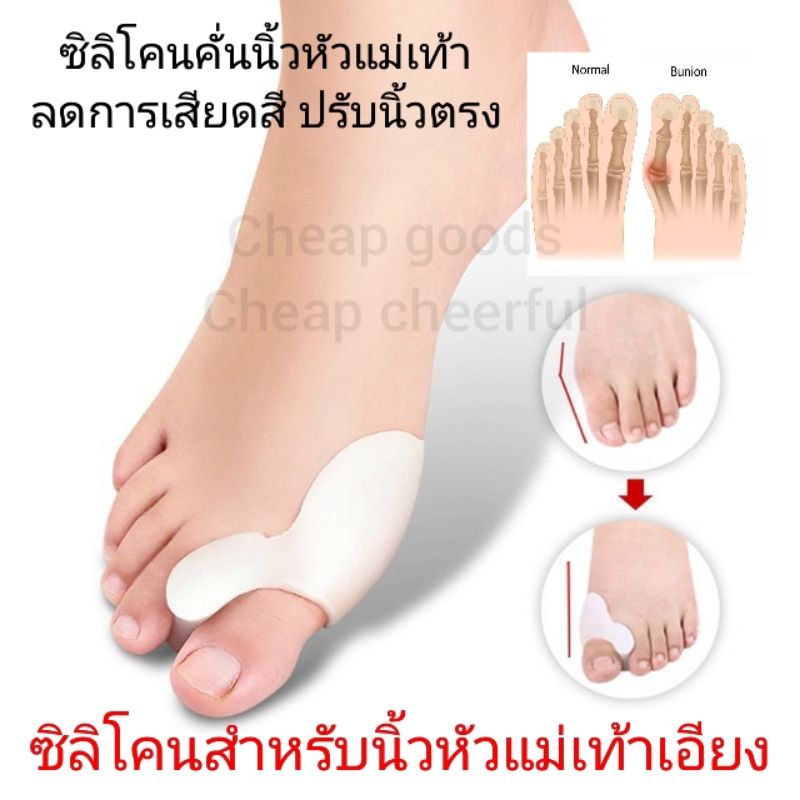 ลดปวดนิ้วเท้าคด กระดูกเท้านูน ซิลิโคนคั่นนิ้วเท้า ลดการเสียดสีในรองเท้า กระดูกนิ้วเท้า Hallux Valgus Bunion Care