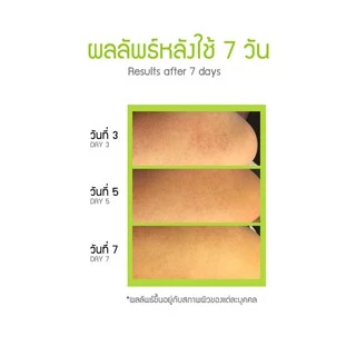 Hanedo ชุดเคลียร์ขนคุด ผิวหนังไก่ ปรับผิวให้เรียบเนียน KP Advanced Lotion Plus Rose Extract and Soap set 450ml