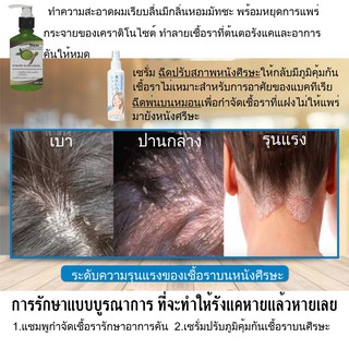 แชมพูสมุนไพรชาเขียว Sharon 120ml +เซรั่มขิง 100ml ชุดรักษาแบบบูรณาการ  คันหัว เชื้อรา รังแค รุนแรงลองหลายวิธีแล้วไม่หาย