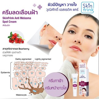 Skin Frink ครีมลดเลือนฟ้า ครีมทาฝ้า ครีมหน้าขาวใส ครีมแก้ฝ้ากระ ลดเลือนจุดด่างดำ/สีผิวไม่สม่ำเสมอ ครีมทาฝ้าหนาๆ หน้าใส