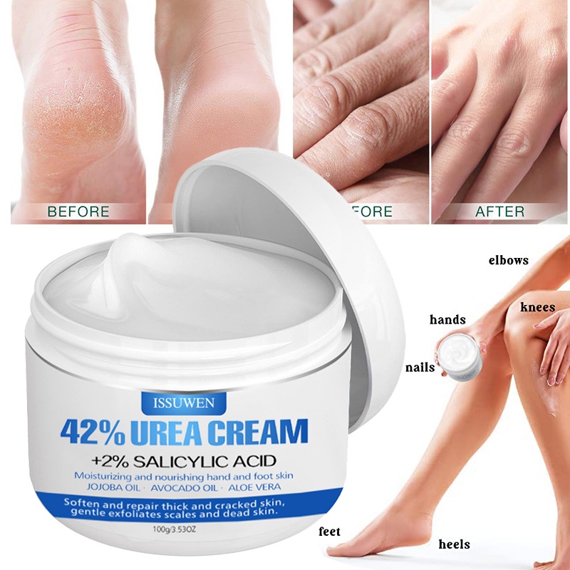 Urea Cream 40% Plus Salicylic Acid 4.6 Oz แฮนด์ครีม กําจัดแคลลัส สําหรับผิวแห้งแตก เท้า มือ ส้นเท้า ข้อศอก เล็บ เข่า ให้ความชุ่มชื้น และผิวนุ่ม