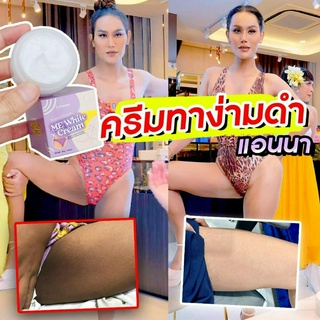 ครีมทาง่ามขาแม่แอนนา ครีมแอนนา ครีมทาขาหนีบดำ เปลี่ยนง่ามขา รักแร้ ข้อศอก เข่า ก้น ตาตุ่ม ให้เนียนใสด้วย…#ไอคราวมีไวท์คร