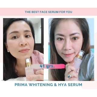 PRIMA Whitening &amp; Hya Serum เซรั่มบำรุงผิวหน้า เพิ่ม Hya เข้มข้น ลดความหมองคล้ำ ลดฝ้า กระ จุดด่างดำ