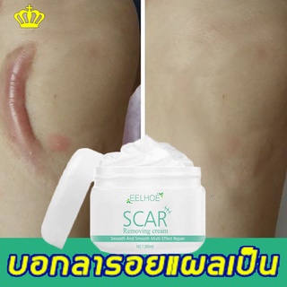 ครีมลดรอยแผลเป็น✅ครีมทาแผลเป็น รอยสิว 30ml แผลอุบัติเหตุ ไฟไหม้ น้ำร้อนลวก รอยสิว (ครัมทารอยแผลเป็น ครีมลบรอยแผลเป็น ครีมรักษาแผลเป็น ครีมลดรอยสิว ครีมลบแผลเป็น ลดเลือนแผลผ่าตัดการคลอด รอยแตกลายหลังผ่าตัด รอยแตกลายหลังคลอด)