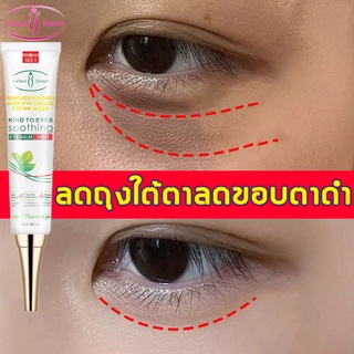 eye cream อายครีม อายครีมบำรุงตา ครีมบำรุงรอบดวงตา ครีมทารอบดวงตา ครีมทาใต้ตาดำ ครีมลดถุงใต้ตา ครีมบำรุงใต้ตา