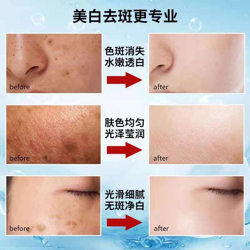 ผลิตภัณฑ์ดูแลผิวหน้าaThree Corrections Whitening Cream + Aolai Facial Cleanser for whitening, freckle and Brighteningผิ