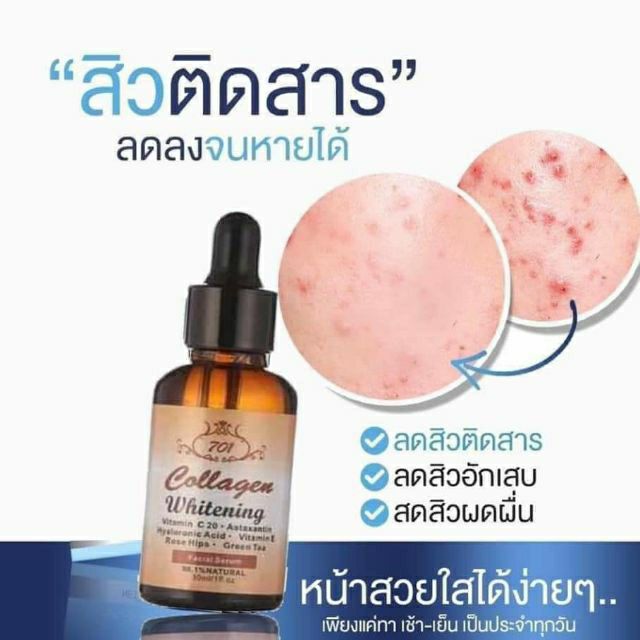 สิว ฝ้า กระลึก เคยใช้สารพัดครีมก็ไม่หาย

เซรั่มหน้าใสไร้สิวและริ้วรอย ขวดเดียวรับรองหน้าเป๊ะเวอร์