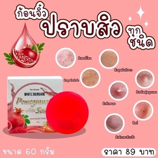 สบู่ทับทิม ปราบสิว ผิวใส ลดฝ้า รอยดำ รอยแดง