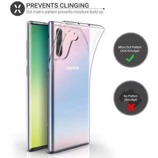 Samsung Galaxy A9 A8s A8 A7 A6s A6 A01 A2 Core Plus Star 2018 เคสกันกระแทก TPU แบบใสกลับเคสกันกระแทกใส