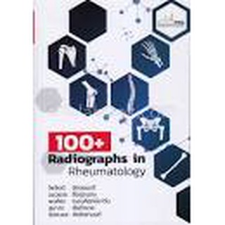 9786164220508 100+ RADIOGRAPHS IN RHEUMATOLOGY