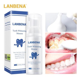 【Horec】ยาสีฟันมูสแปรงฟัน ฟอกฟันขาว LANBENA Teeth Whitening Mousse 60 ml. ฟอกฟันขาว ขัดคราบเหลือง ดับกลิ่นปาก กลิ่นหอมสดชื่น