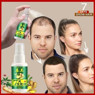 พร้อมส่ง! เซรั่มปลูกผม สูตรขิง ลดผมร่วง สําหรับผู้ชาย และผู้หญิง ขนาด 30 มล.