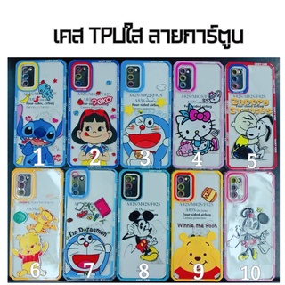 เคสใส ลายการ์ตูน  สำหรับ Samsung รุ่น  A31 A51 A71