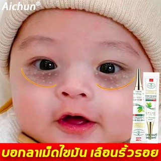 Aichun เซรั่มทาถุงใต้ตา 30ML อายครีม เม็ดไขมัน ครีมไต้ตา ครีมทาใต้ตาดำ บำรุงสายตา ครีมทาตาดำ ครีมทารอบดวงตา รอยตีนกา