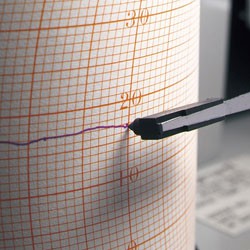 ปากกาตลับบันทึก Sato สําหรับ Isuzu และ Sato Thermohygrograph