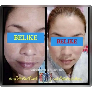 รับจากบริษัทโดยตรง 🌟 ครีม บีไล Belike บีไลค์ แก้ปัญหา สิว ฝ้า กระ หน้าหมองคล้ำ ขาว ไม่มีสารอันตราย