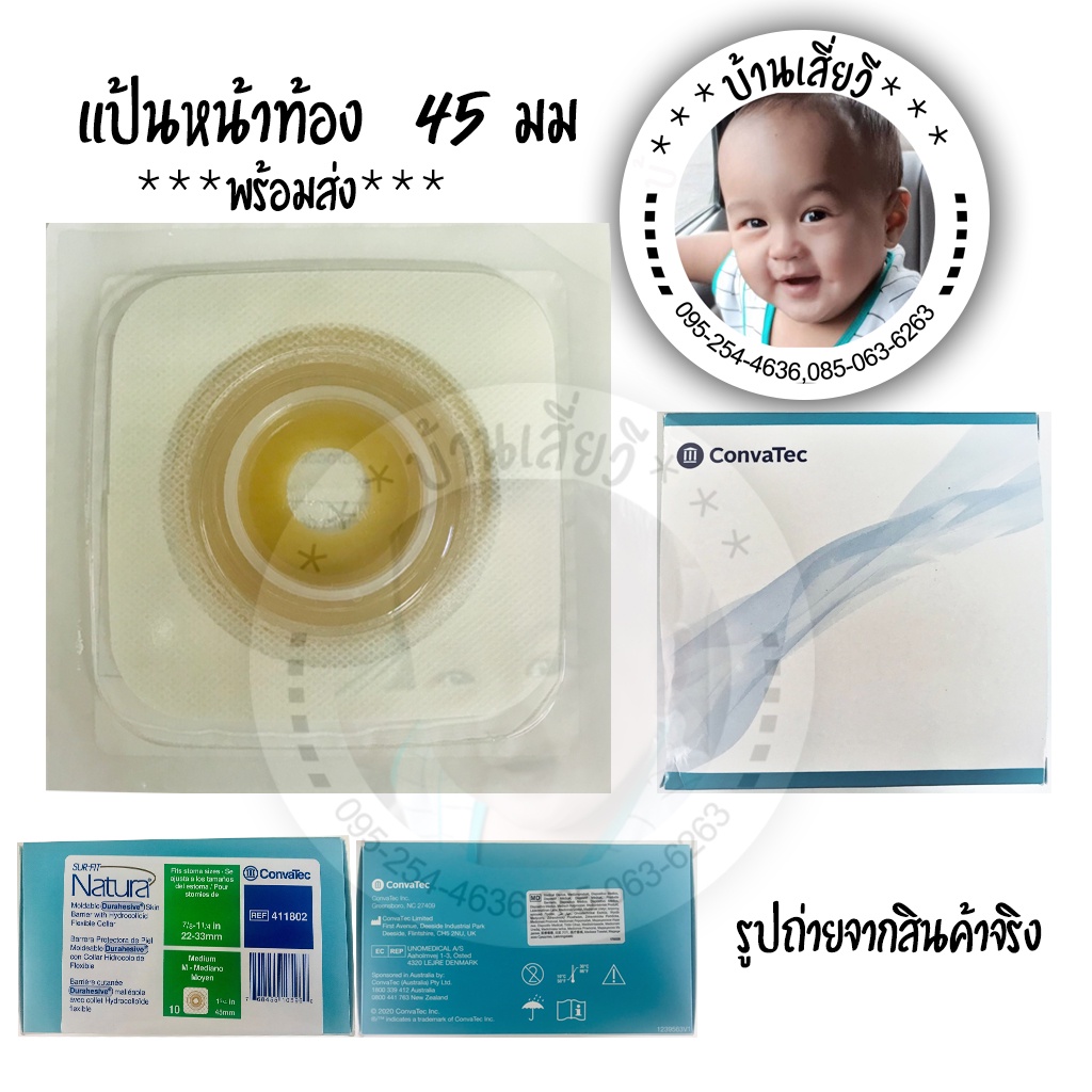 *พร้อมส่ง* แป้นหน้าท้อง CONVATEC  Stomahesive ขนาด 45 มม.  แป้นสำหรับติดถุงอุจจาระ/ถุงหน้าท้อง  แป้น