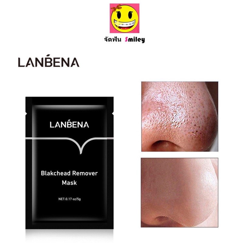 LANBENA แท้ มาส์กลอกสิวเสี้ยน โคลนลอกสิวเสี้ยน ครีมลอกสิว ออกจริง