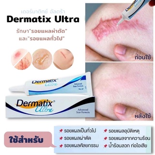 🔥พร้อมส่ง🔥นำเข้าจากอเมริกา,Dermatix Ultra ,Gel 15g ,เดอร์มาติกซ์ อัลตร้า ,ลดรอยแผลเป็น,เจลลดรอยแผลเป็น