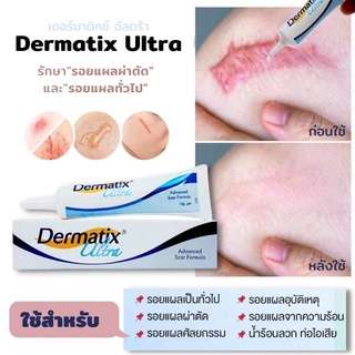 🔥พร้อมส่ง🔥นำเข้าจากอเมริกา,Dermatix Ultra ,Gel 15g ,เดอร์มาติกซ์ อัลตร้า ,ลดรอยแผลเป็น,เจลลดรอยแผลเป็น