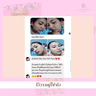 เซรั่มลาโมน่า ของแท้💯% 🛍มีของแถมทุกออเดอร์