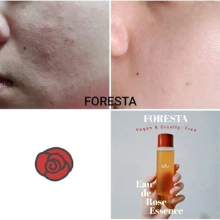 (ตัวแทน) Foresta Eau de rose essence 100 ml. น้ำตบชากุหลาบ ฟอเรสต้า ขนาด 100 ml.