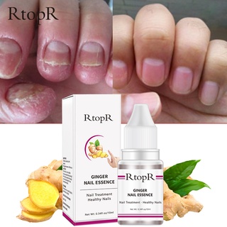 RtopR ยาทาเล็บป้องกันเชื้อแบคทีเรีย รักษาโรคเชื้อราที่เล็บ เล็บพัง ดูแลเล็บ 10ml