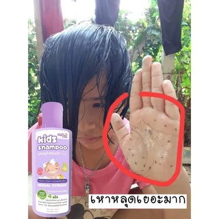 แชมพูเหา+ครีมนวดซอง 50g สูตรสมุนไพร อ่อนโยน ไม่ระคายเคือง ไม่แสบตา แชมพูเหาเด็ก 1ขวบใช้ได้